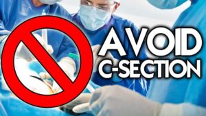 Turcia a interzis cezarienele la cerere când acestea au depășit 60%. Motivul: ”Pentru sănătatea nației